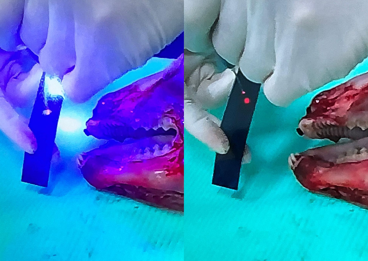 medency corso rossi vigliaroli dental laser