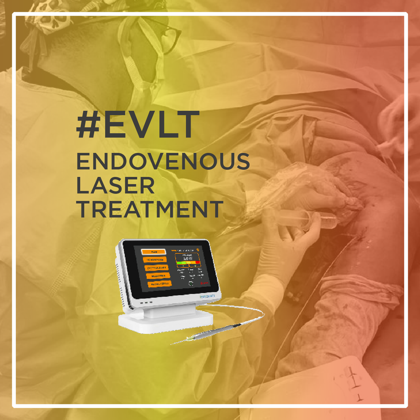 Read more about the article EVLT with Rapido MED | Marocco
